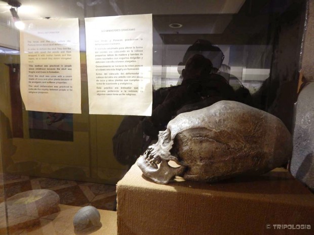 Deformirana lubanja nalik je nečem vanzemaljskom